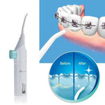 Dental water flosser